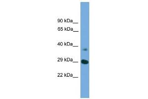 WB Suggested Anti-ATG16L1 Antibody Titration: 0. (ATG16L1 抗体  (Middle Region))