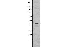 Western blot analysis of Phospho-PKA C (Thr197) using COLO205 whole cell lysates