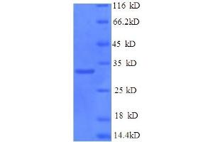 SDS-PAGE (SDS) image for Protein Kinase, DNA-Activated, Catalytic Polypeptide (PRKDC) (AA 3747-4015) protein (His tag) (ABIN5710145)