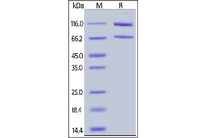 SDS-PAGE (SDS) image for Complement Component 5 (C5) (AA 19-1676) (Active) protein (His tag) (ABIN6809857)