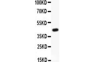 Western blot analysis of MRP4 using anti-MRP4 antibody (ABIN3043774).