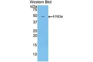 Detection of Recombinant LTbR, Mouse using Polyclonal Antibody to Lymphotoxin Beta Receptor (LTbR) (LTBR 抗体  (AA 128-395))