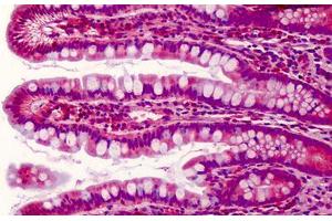 Human Small Intestine: Formalin-Fixed, Paraffin-Embedded (FFPE) (PDCD5 抗体  (C-Term))