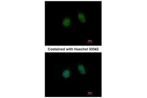 ICC/IF Image Immunofluorescence analysis of paraformaldehyde-fixed HeLa, using Annexin V, antibody at 1:500 dilution. (Annexin V 抗体)