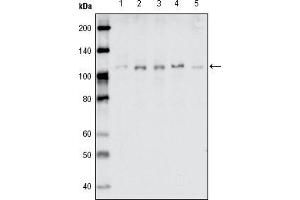 Western blot analysis using EhpB1 mouse mAb against MDA-MB-468 (1), MDA-MB-453 (2), MCF-7 (3), T47D (4) and SKBR-3 (5) cell lysate. (EhpB1 (AA 19-133) 抗体)