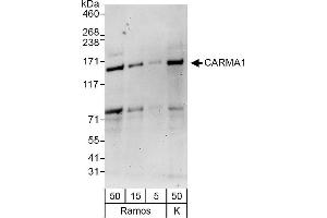 Western Blotting (WB) image for anti-Caspase Recruitment Domain Family, Member 11 (CARD11) (AA 575-625) antibody (ABIN7451678)