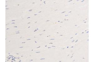 Immunohistochemistry (IHC) image for anti-Receptor tyrosine-protein kinase erbB-2 (ErbB2/Her2) (pTyr877) antibody (ABIN6256054)