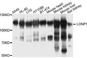 Western blot analysis of extracts of various cell lines, using LONP1 antibody. (LONP1 抗体  (AA 120-400))