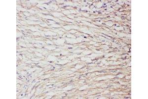 Immunohistochemistry (IHC) image for anti-Glial Fibrillary Acidic Protein (GFAP) (AA 93-432) antibody (ABIN3031046)