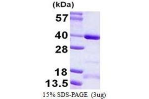 Image no. 1 for Coiled-Coil Domain Containing 101 (CCDC101) (AA 1-293) protein (His tag) (ABIN1098232)