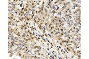 IHC analysis of MNT using anti-MNT antibody (ABIN7601555). (MNT 抗体  (AA 381-564))
