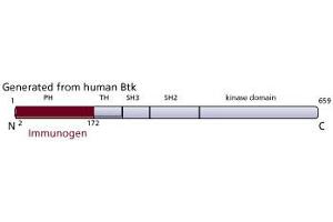 Image no. 2 for anti-Bruton Agammaglobulinemia tyrosine Kinase (BTK) (AA 2-172), (N-Term) antibody (ABIN968375)