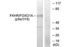 Western blot analysis of extracts from HeLa cells treated with EGF, using FKHR (Phospho-Ser319) Antibody. (FOXO1 抗体  (pSer319))