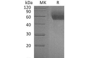 Western Blotting (WB) image for Interleukin 1 Receptor-Like 1 (IL1RL1) protein (His tag) (ABIN7320553) (IL1RL1 Protein (His tag))