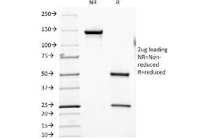 SDS-PAGE Analysis Purified CD6 Mouse Monoclonal Antibody (SPV-L14). (CD6 抗体)