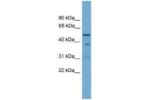 Human PANC1; WB Suggested Anti-TINAG Antibody Titration: 0. (TINAG 抗体  (Middle Region))