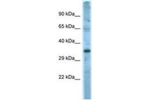 Image no. 1 for anti-Fas Ligand (TNF Superfamily, Member 6) (FASL) (AA 121-170) antibody (ABIN6748197) (FASL 抗体  (AA 121-170))