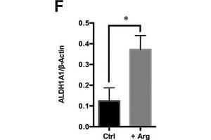 Arg supplementation activates ethanol degradation pathways in HepG2 cells.