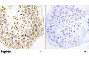 Immunohistochemistry analysis of paraffin-embedded human testis tissue, using SPZ1 polyclonal antibody . (SPZ1 抗体)