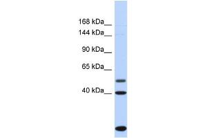Host:  Rabbit  Target Name:  PSD3  Sample Type:  Fetal Heart lysates  Antibody Dilution:  1. (PSD3 抗体  (C-Term))