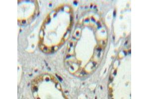 Used in DAB staining on fromalin fixed paraffin-embedded kidney tissue (PLVAP 抗体  (AA 123-393))