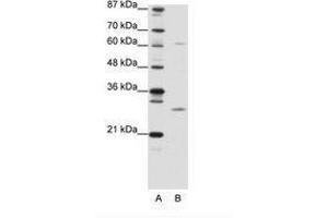 Image no. 1 for anti-Mediator Complex Subunit 7 (MED7) (N-Term) antibody (ABIN6736137)