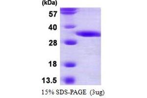 SDS-PAGE (SDS) image for 2,4-Dienoyl CoA Reductase 2, Peroxisomal (DECR2) (AA 1-292) protein (His tag) (ABIN667629) (DECR2 Protein (AA 1-292) (His tag))