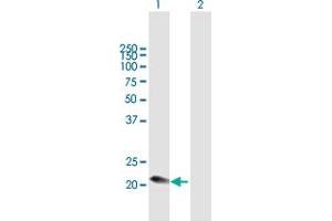 Western Blot analysis of C1QC expression in transfected 293T cell line by C1QC MaxPab polyclonal antibody.