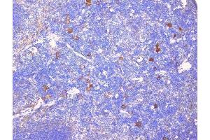 IHC analysis of CD229 using anti-CD229 antibody (ABIN6719290). (LY9 抗体)
