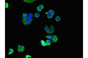 Immunofluorescent analysis of MCF-7 cells using ABIN7160555 at dilution of 1:100 and Alexa Fluor 488-congugated AffiniPure Goat Anti-Rabbit IgG(H+L) (MYL9 抗体  (AA 2-172))