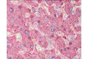 Immunohistochemistry of Goat Anti-Fibrinogen antibody. (FGA 抗体)