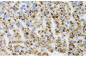 Immunohistochemistry of paraffin-embedded Rat liver using NTRK1 Polyclonal Antibody at dilution of 1:100 (40x lens). (TRKA 抗体)
