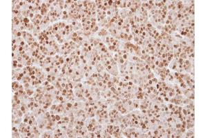 IHC-P Image Immunohistochemical analysis of paraffin-embedded BT483 xenograft, using UHRF1, antibody at 1:250 dilution. (UHRF1 抗体)