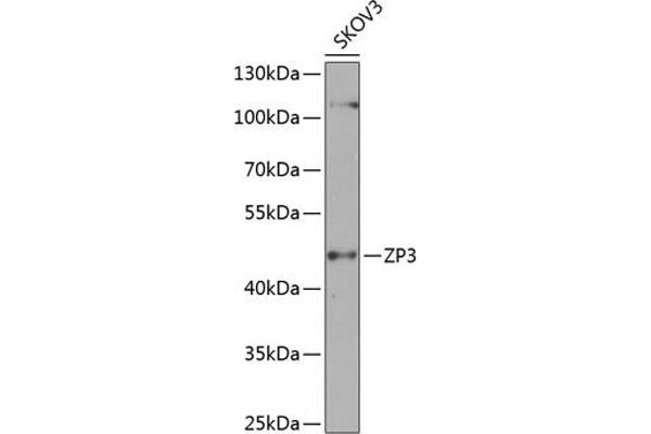 Zona Pellucida Glycoprotein 3 抗体  (AA 170-390)