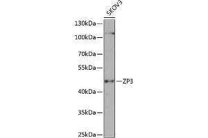 Western blot analysis of extracts of SKOV3 cells, using ZP3 antibody (ABIN6130818, ABIN6150537, ABIN6150539 and ABIN6224382) at 1:1000 dilution. (Zona Pellucida Glycoprotein 3 抗体  (AA 170-390))
