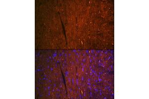 Immunofluorescence analysis of mouse heart using F Rabbit mAb (ABIN7267152) at dilution of 1:100 (40x lens). (FABP3 抗体)