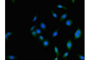 Immunofluorescence (IF) image for anti-Proteasome (Prosome, Macropain) 26S Subunit, Non-ATPase, 2 (PSMD2) (AA 401-700), (Regulatory Subunit 2) antibody (ABIN7142208)