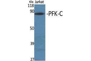 Western Blot (WB) analysis of specific cells using PFK-C Polyclonal Antibody. (PFKP 抗体  (Internal Region))