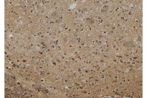 ABIN6273061 at 1/100 staining Rat brain tissue by IHC-P. (OIP5 抗体  (C-Term))