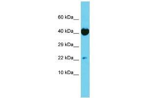 Host: Rabbit Target Name: TRAPPC6A Sample Type: HT1080 Whole Cell lysates Antibody Dilution: 1. (TRAPPC6A 抗体  (N-Term))