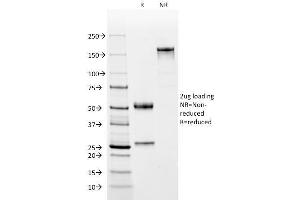 SDS-PAGE Analysis Purified CD2 Mouse Monoclonal Antibody (BH1). (CD2 抗体)