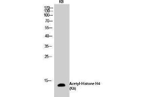 Western Blotting (WB) image for anti-Histone H4 (acLys8) antibody (ABIN6285518) (Histone H4 抗体  (acLys8))