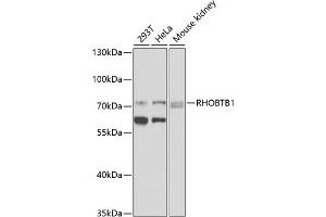 Western blot analysis of extracts of various cell lines, using RHOBTB1 antibody (ABIN6128679, ABIN6146936, ABIN6146937 and ABIN6225297) at 1:1000 dilution. (RHOBTB1 抗体  (AA 240-400))