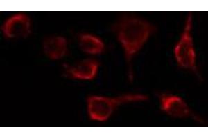 ABIN6269323 staining HeLa cells by IF/ICC. (LIPE 抗体  (Internal Region))