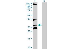 Western Blot analysis of RCHY1 expression in transfected 293T cell line by RCHY1 MaxPab polyclonal antibody. (RCHY1 抗体  (AA 1-252))