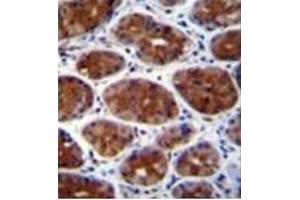 Immunohistochemistry (Paraffin-embedded Sections) (IHC (p)) image for anti-Cleavage and Polyadenylation Specific Factor 3-Like (CPSF3L) (AA 98-126), (N-Term) antibody (ABIN951683)