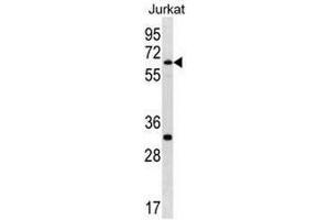 SMARCD1 Antibody (C-term) western blot analysis in Jurkat cell line lysates (35µg/lane). (SMARCD1 抗体  (C-Term))