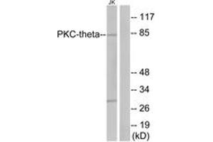 Western blot analysis of extracts from Jurkat cells, treated with PMA 200nM 30', using PKC thet (Ab-676) Antibody. (PKC theta 抗体  (AA 643-692))