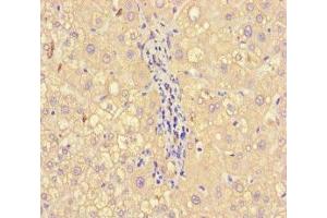 Immunohistochemistry of paraffin-embedded human liver tissue using ABIN7143790 at dilution of 1:100 (alpha 2 Macroglobulin 抗体  (AA 1216-1467))