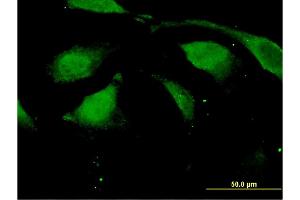 Immunofluorescence of monoclonal antibody to DAZAP2 on HeLa cell. (DAZAP2 抗体  (AA 93-168))